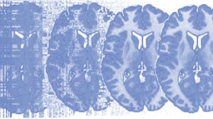 Principles of fMRI 2