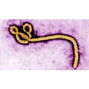 埃博拉病毒：疫情发展