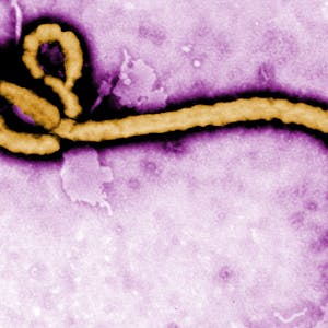 Ebola Virus Disease: An Evolving Epidemic from Coursera | Course by Edvicer