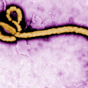 Ebola Virus Disease An Evolving Epidemic