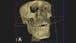 Introduction to Dental Medicine