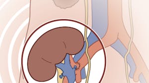 Clinical Kidney, Pancreas and Islet Transplantation