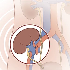 Clinical Kidney, Pancreas and Islet Transplantation