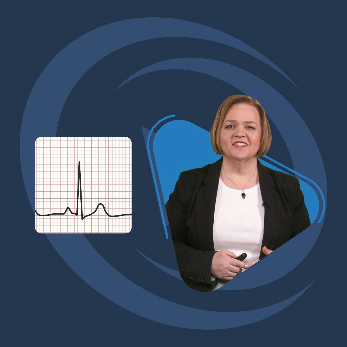 Electrocardiogram (ECG)