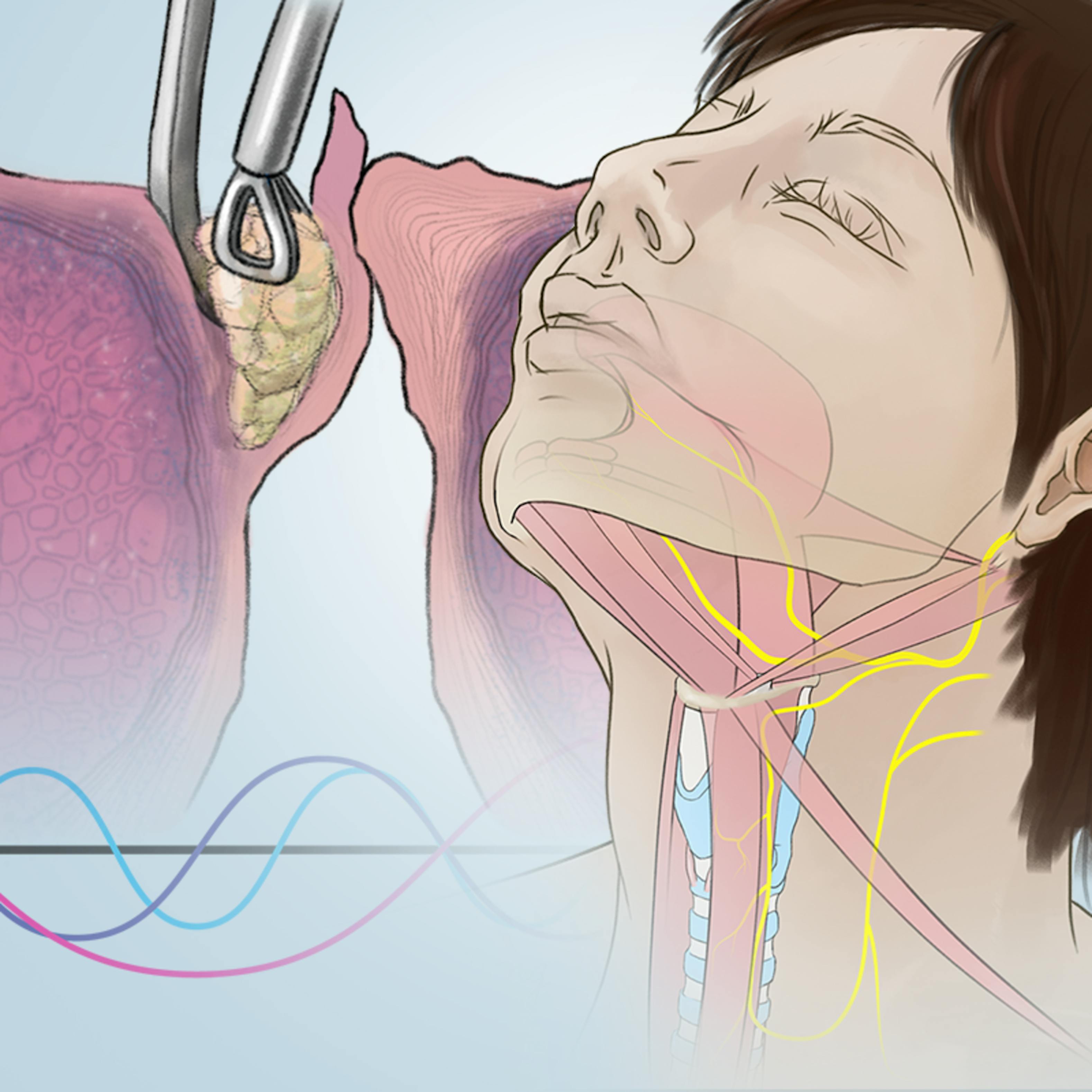 Voice Disorders What Patients And Professionals Need To - 