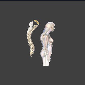 Machine Learning for Kyphosis Disease Classification - Online CE Course