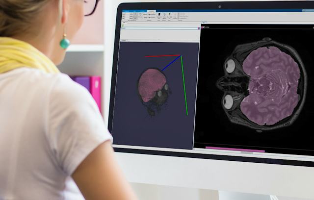 Hardware Image Processing Course Introduction to Image Processing | Coursera