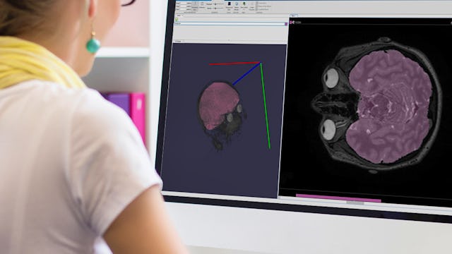 Medical Image Processing | Coursera