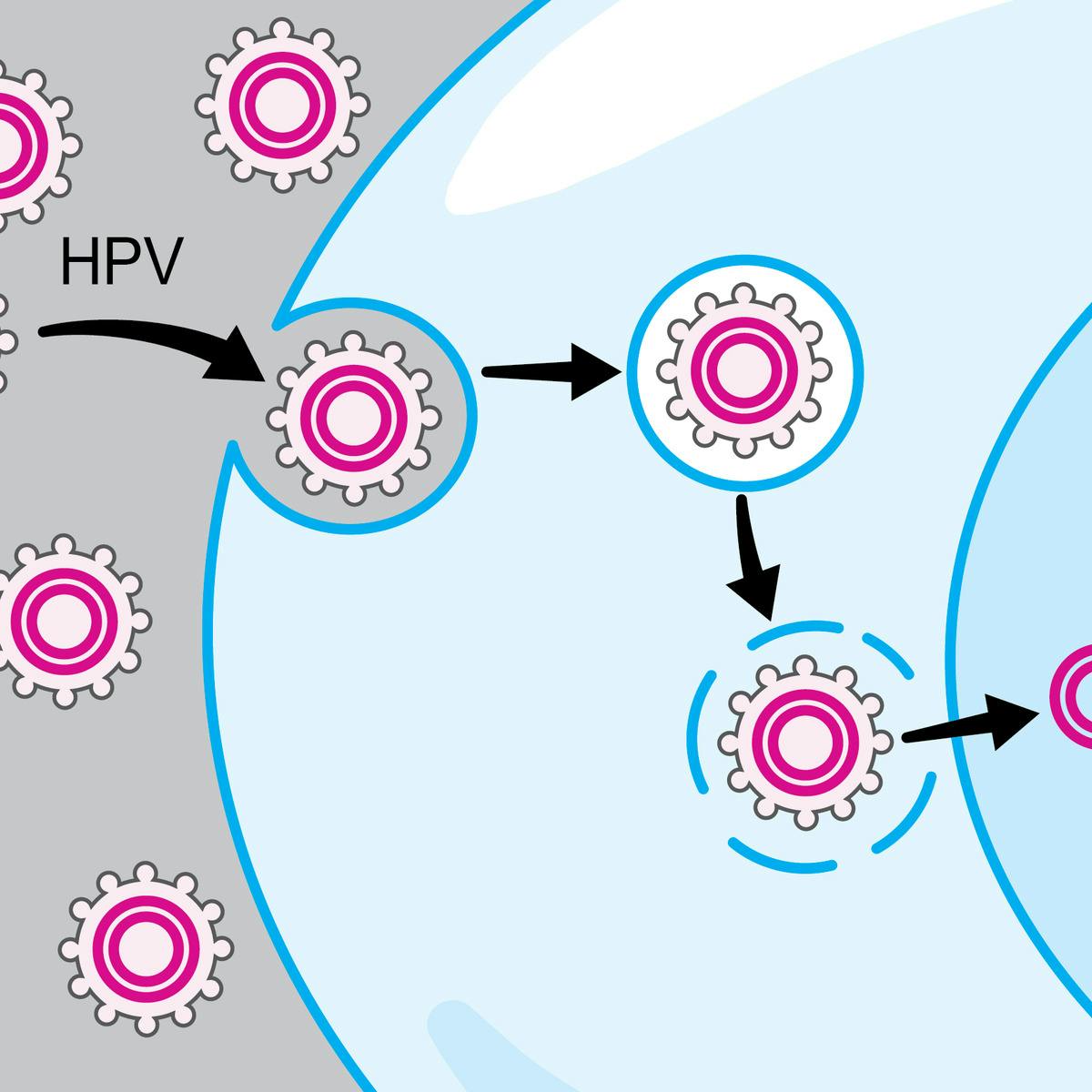 Hpv Associated Oral And Throat Cancer What You Need To Know Coursera