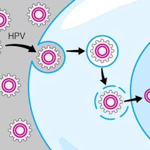 HPV-Associated Oral and Throat Cancer What You Need to Know