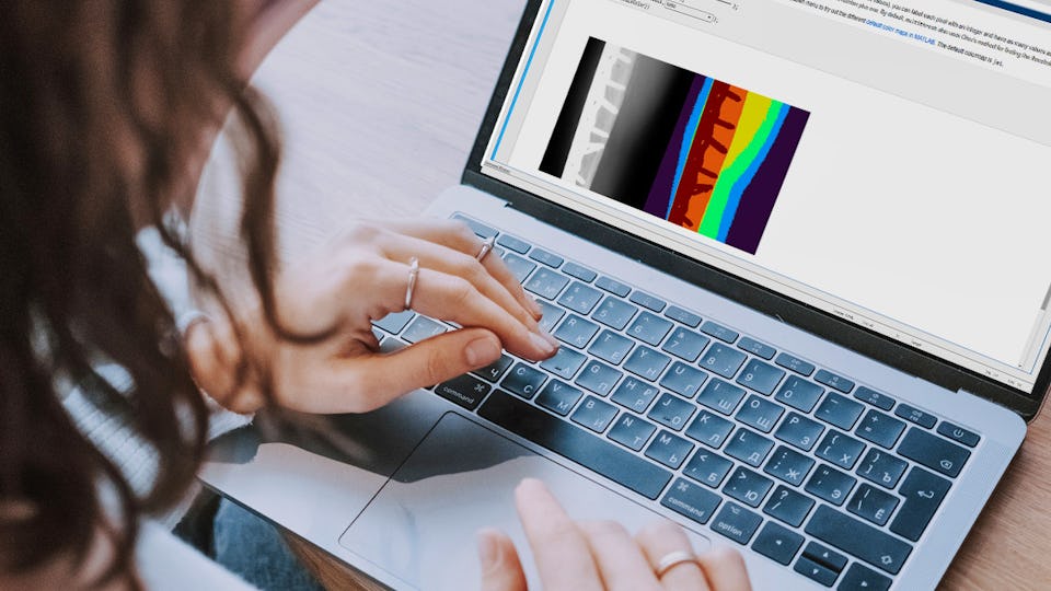 Getting started with ImageJ