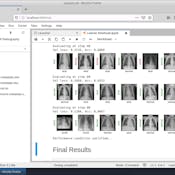 Detecting COVID-19 with Chest X-Ray using PyTorch