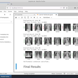 Image for the Detecting COVID-19 with Chest X-Ray using PyTorch course