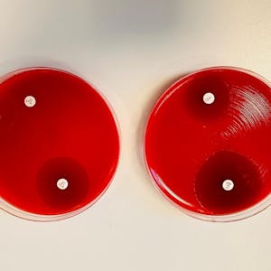 Image for the Antimicrobial resistance - theory and methods course