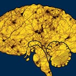 Sleep: Neurobiology, Medicine, and Society