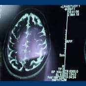 Visualizing the Living Body: Diagnostic Imaging
