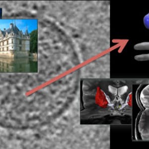 Image and Video Processing From Mars to Hollywood with a Stop at the Hospital