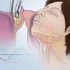Introduction to Ear, Nose, and Throat Disorders Specialization