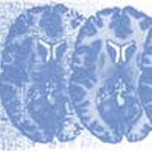 Neuroscience and Neuroimaging - Online CE Course