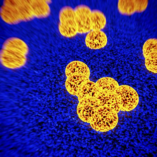 Portada: Prevención de infecciones en residencias de ancianos