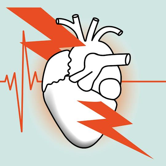 Portada: Infarto de miocardio