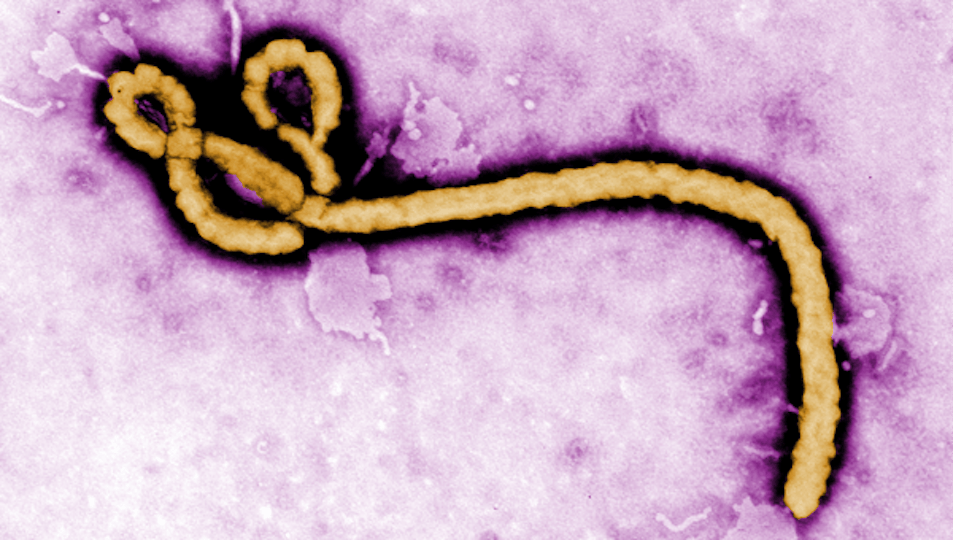 Portada: La enfermedad por el virus del Ébola: Una epidemia en evolución