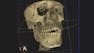 Introduction to Dental Medicine