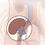 Clinical Kidney, Pancreas and Islet Transplantation by Universiteit Leiden, Leiden University Medical Center