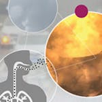 Air Pollution – a Global Threat to our Health image