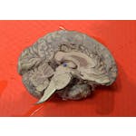 Understanding the Brain: The Neurobiology of Everyday Life image