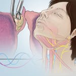 Voice Disorders: What Patients and Professionals Need to Know image