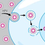 HPV-Associated Oral and Throat Cancer: What You Need to Know 