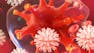 Fundamentals of Immunology: Inflammation, Tolerance, Autoimmunity