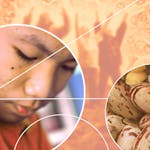 Diabetes – the Essential Facts image