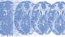 Principles of fMRI 1
