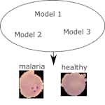 Malaria parasite detection using ensemble learning in Keras by Coursera Project Network