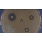Antimicrobial resistance - theory and methods image