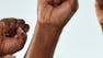Achieving Health Equity in Healthcare