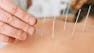 Applied Acupuncture Techniques for Common Conditions
