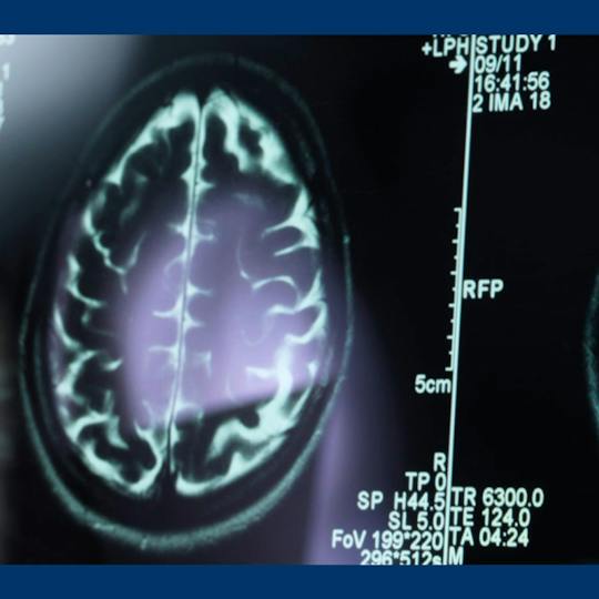 Portada: Visualizar el cuerpo vivo: Diagnóstico por imagen